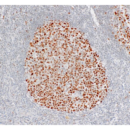 Immunohistochemistry - Anti-Bcl6 Antibody [IHC029] (A324399) - Antibodies.com