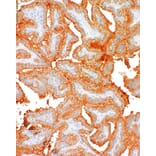 Immunohistochemistry - Anti-BRAF (mutated V600E) Antibody [IHC600] (A324400) - Antibodies.com