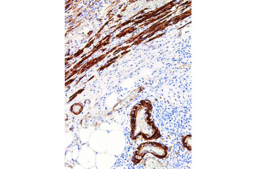 Immunohistochemistry - Anti-Caldesmon/CDM Antibody [IHC522] (A324401) - Antibodies.com