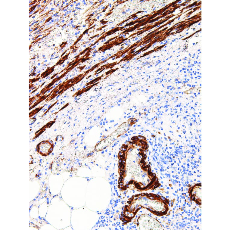 Immunohistochemistry - Anti-Caldesmon/CDM Antibody [IHC522] (A324401) - Antibodies.com