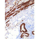 Immunohistochemistry - Anti-Caldesmon/CDM Antibody [IHC522] (A324401) - Antibodies.com