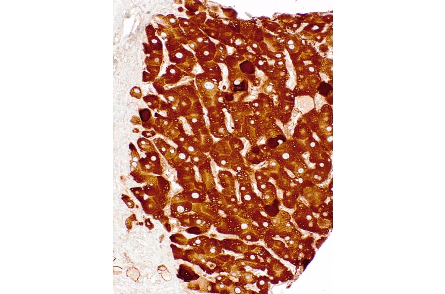 Immunohistochemistry - Anti-Hepatitis B Surface Antigen Antibody [IHC178] (A324402) - Antibodies.com
