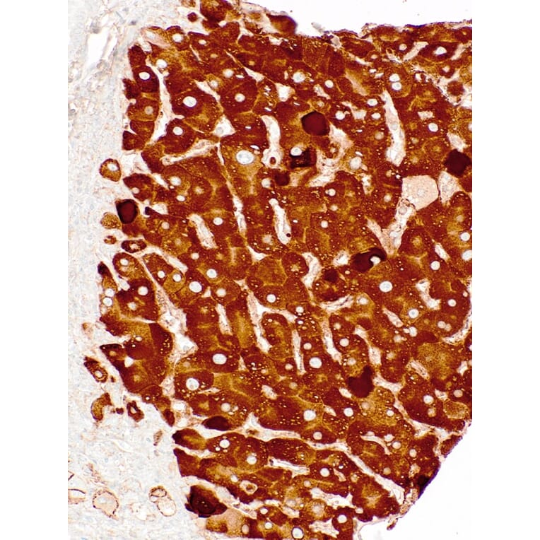 Immunohistochemistry - Anti-Hepatitis B Surface Antigen Antibody [IHC178] (A324402) - Antibodies.com