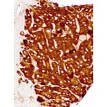 Immunohistochemistry - Anti-Hepatitis B Surface Antigen Antibody [IHC178] (A324402) - Antibodies.com