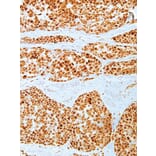 Immunohistochemistry - Anti-MDM2 Antibody [IHC620] (A324403) - Antibodies.com