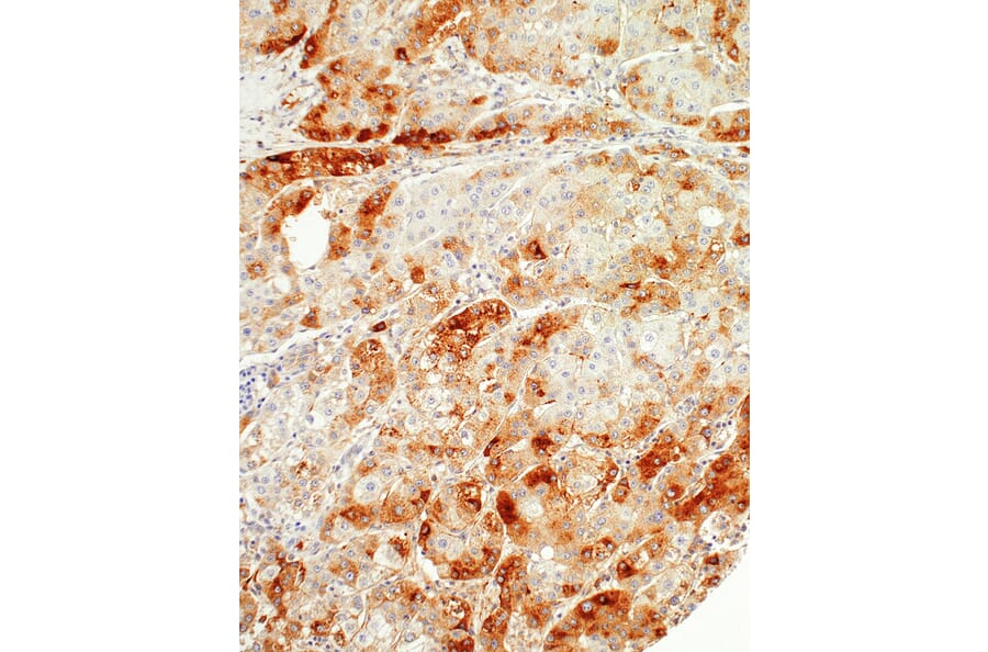 Immunohistochemistry - Anti-SAA1 Antibody [IHC421] (A324404) - Antibodies.com