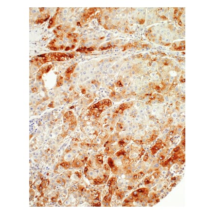 Immunohistochemistry - Anti-SAA1 Antibody [IHC421] (A324404) - Antibodies.com