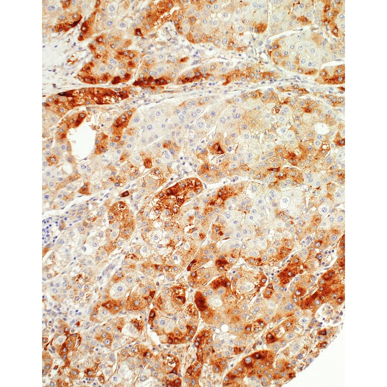 Immunohistochemistry - Anti-SAA1 Antibody [IHC421] (A324404) - Antibodies.com