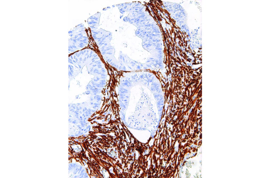 Immunohistochemistry - Anti-alpha Smooth Muscle Actin Antibody [IHC506] (A324405) - Antibodies.com