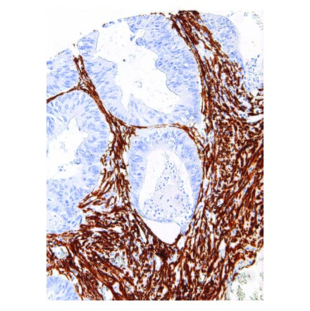 Immunohistochemistry - Anti-alpha Smooth Muscle Actin Antibody [IHC506] (A324405) - Antibodies.com
