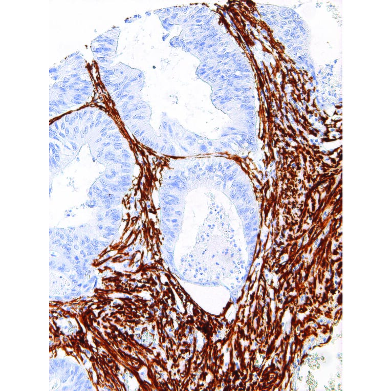 Immunohistochemistry - Anti-alpha Smooth Muscle Actin Antibody [IHC506] (A324405) - Antibodies.com