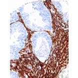 Immunohistochemistry - Anti-alpha Smooth Muscle Actin Antibody [IHC506] (A324405) - Antibodies.com
