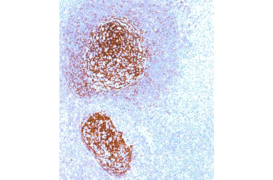 Immunohistochemistry - Anti-CD21 Antibody [IHC533] (A324408) - Antibodies.com