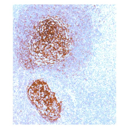 Immunohistochemistry - Anti-CD21 Antibody [IHC533] (A324408) - Antibodies.com