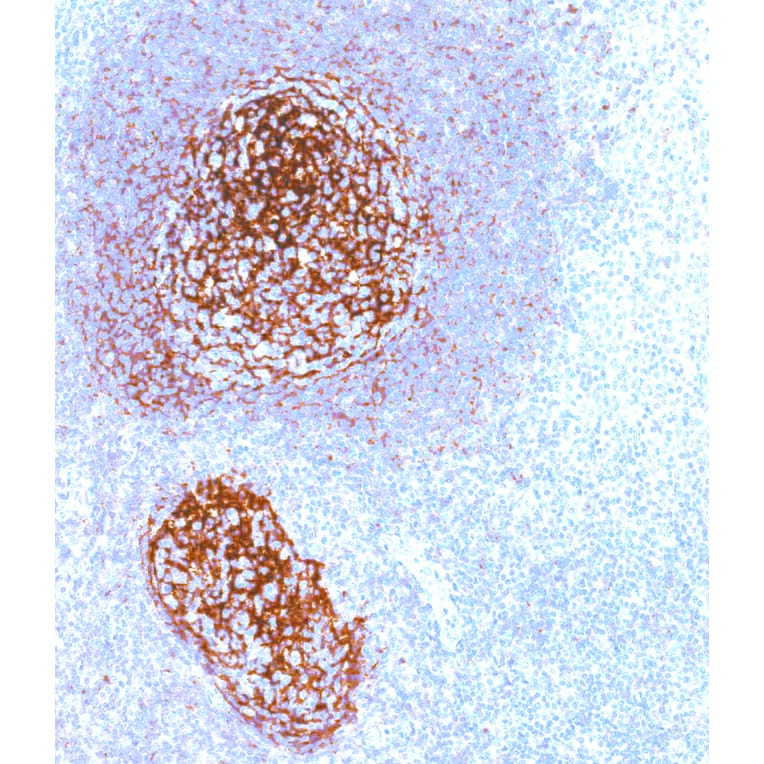 Immunohistochemistry - Anti-CD21 Antibody [IHC533] (A324408) - Antibodies.com