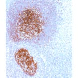 Immunohistochemistry - Anti-CD21 Antibody [IHC533] (A324408) - Antibodies.com