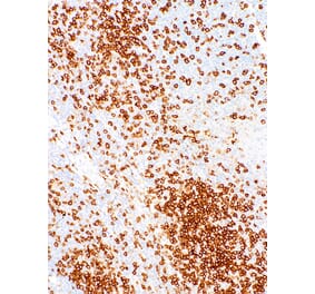 Immunohistochemistry - Anti-CD45RO Antibody [IHC537] (A324409) - Antibodies.com