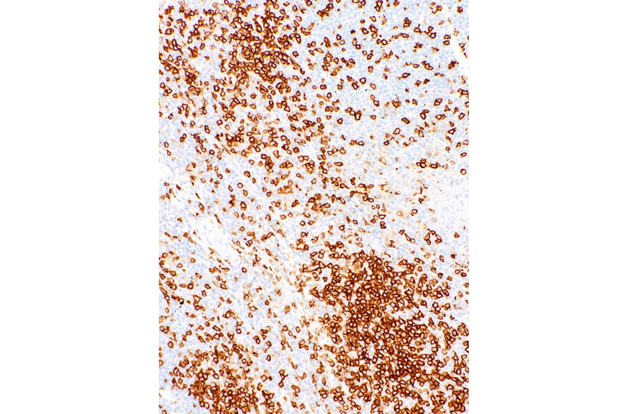 Immunohistochemistry - Anti-CD45RO Antibody [IHC537] (A324409) - Antibodies.com