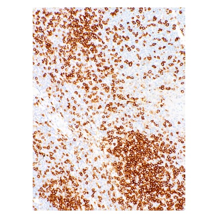 Immunohistochemistry - Anti-CD45RO Antibody [IHC537] (A324409) - Antibodies.com