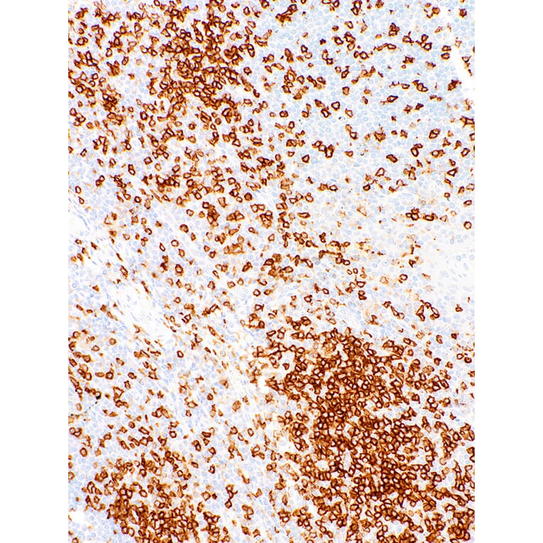 Immunohistochemistry - Anti-CD45RO Antibody [IHC537] (A324409) - Antibodies.com