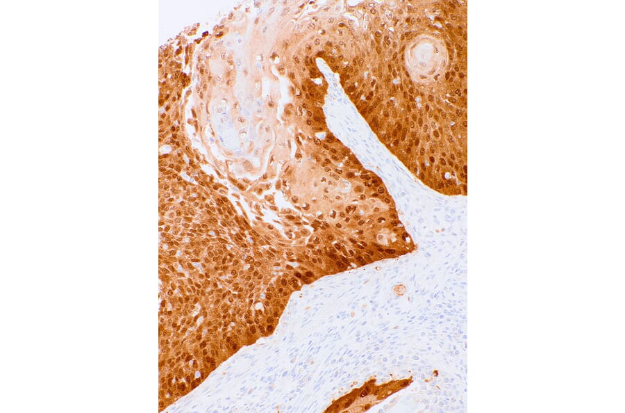 Immunohistochemistry - Anti-CDKN2A/p16INK4A Antibody [IHC216] (A324410) - Antibodies.com