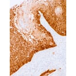 Immunohistochemistry - Anti-CDKN2A/p16INK4A Antibody [IHC216] (A324410) - Antibodies.com