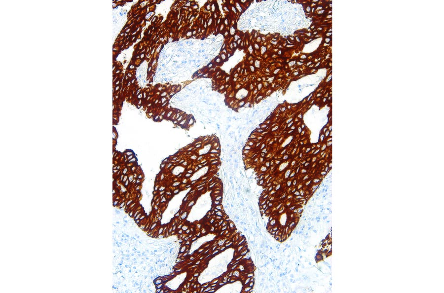Immunohistochemistry - Anti-Cytokeratin 7 Antibody [IHC007] (A324411) - Antibodies.com