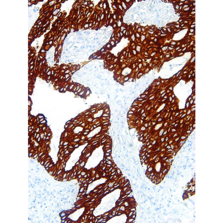 Immunohistochemistry - Anti-Cytokeratin 7 Antibody [IHC007] (A324411) - Antibodies.com
