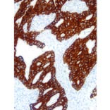 Immunohistochemistry - Anti-Cytokeratin 7 Antibody [IHC007] (A324411) - Antibodies.com