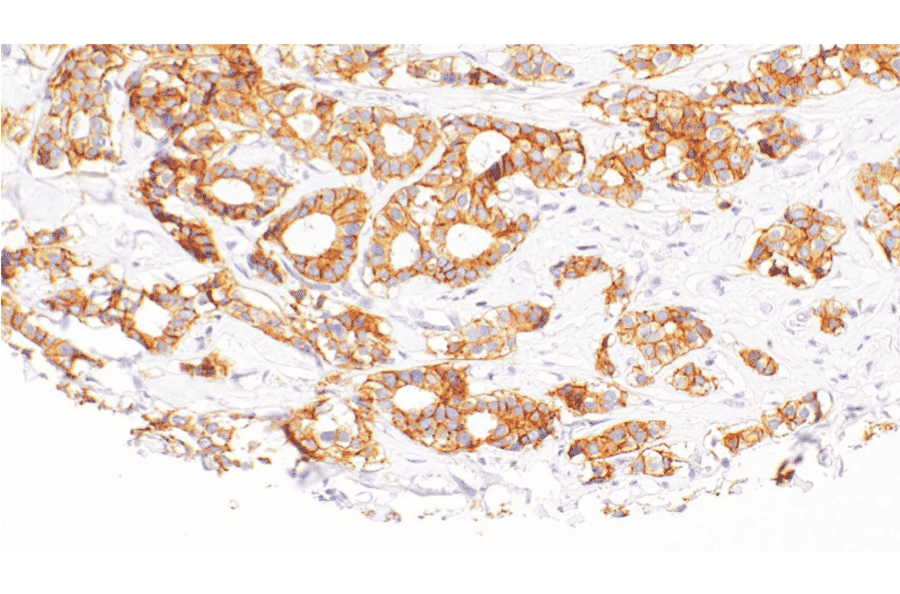 Immunohistochemistry - Anti-ErbB3/HER3 Antibody [IHC113] (A324413) - Antibodies.com