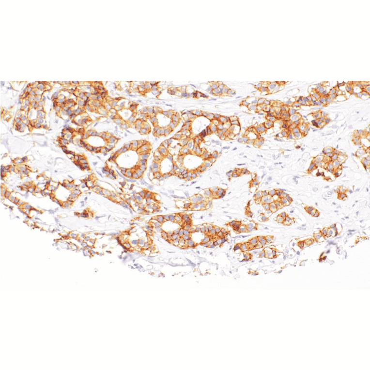 Immunohistochemistry - Anti-ErbB3/HER3 Antibody [IHC113] (A324413) - Antibodies.com