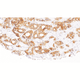 Immunohistochemistry - Anti-ErbB3/HER3 Antibody [IHC113] (A324413) - Antibodies.com