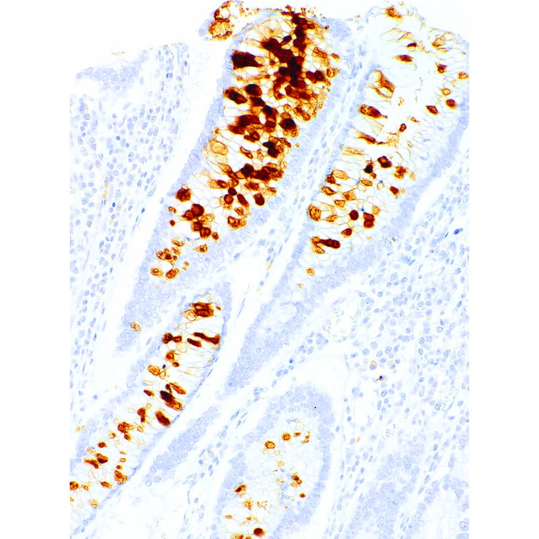 Immunohistochemistry - Anti-Gastric Mucin/MUC-6 Antibody [IHC047] (A324414) - Antibodies.com
