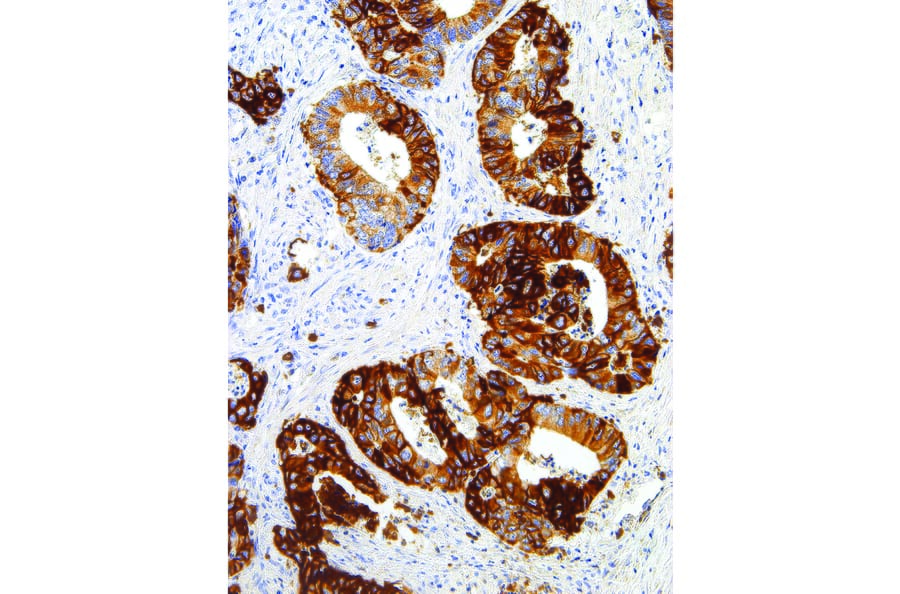 Immunohistochemistry - Anti-Glucose Transporter GLUT1 Antibody [IHC404] (A324416) - Antibodies.com