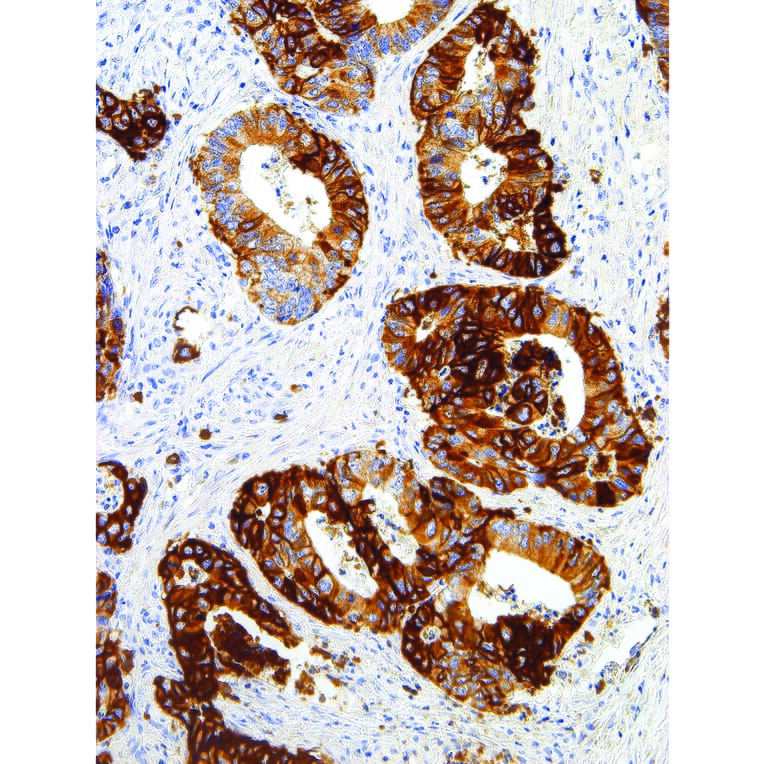 Immunohistochemistry - Anti-Glucose Transporter GLUT1 Antibody [IHC404] (A324416) - Antibodies.com