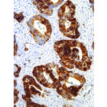 Immunohistochemistry - Anti-Glucose Transporter GLUT1 Antibody [IHC404] (A324416) - Antibodies.com
