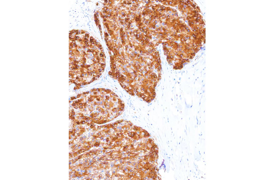 Immunohistochemistry - Anti-Glutamine Synthetase Antibody [IHC586] (A324417) - Antibodies.com