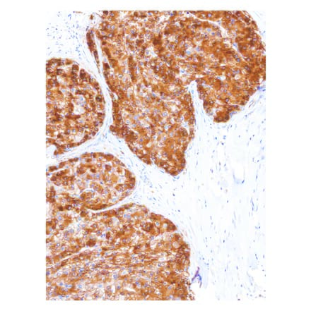 Immunohistochemistry - Anti-Glutamine Synthetase Antibody [IHC586] (A324417) - Antibodies.com