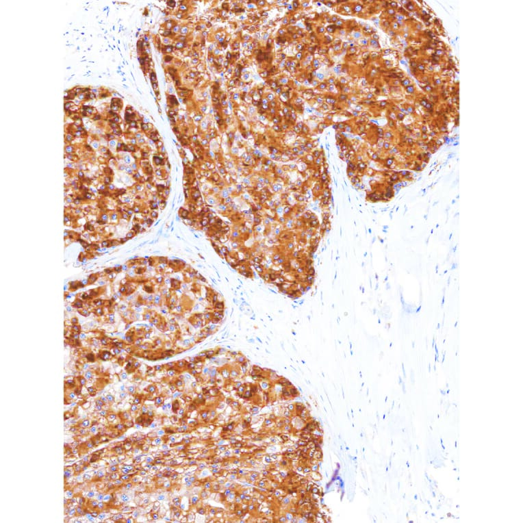 Immunohistochemistry - Anti-Glutamine Synthetase Antibody [IHC586] (A324417) - Antibodies.com