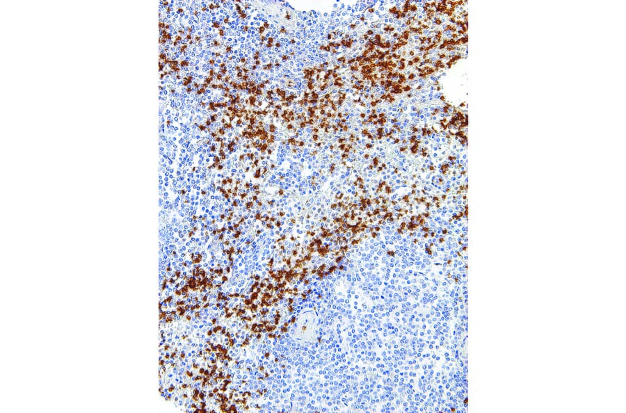 Immunohistochemistry - Anti-Glycophorin A Antibody [IHC587] (A324418) - Antibodies.com