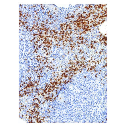 Immunohistochemistry - Anti-Glycophorin A Antibody [IHC587] (A324418) - Antibodies.com