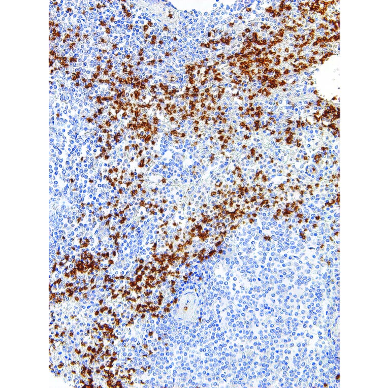 Immunohistochemistry - Anti-Glycophorin A Antibody [IHC587] (A324418) - Antibodies.com