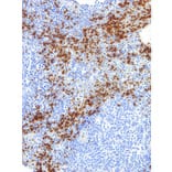 Immunohistochemistry - Anti-Glycophorin A Antibody [IHC587] (A324418) - Antibodies.com