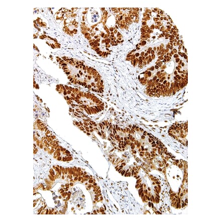 Immunohistochemistry - Anti-MLH1 Antibody [IHC409] (A324420) - Antibodies.com