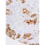 Immunohistochemistry - Anti-MUC1 Antibody [IHC566] (A324421) - Antibodies.com