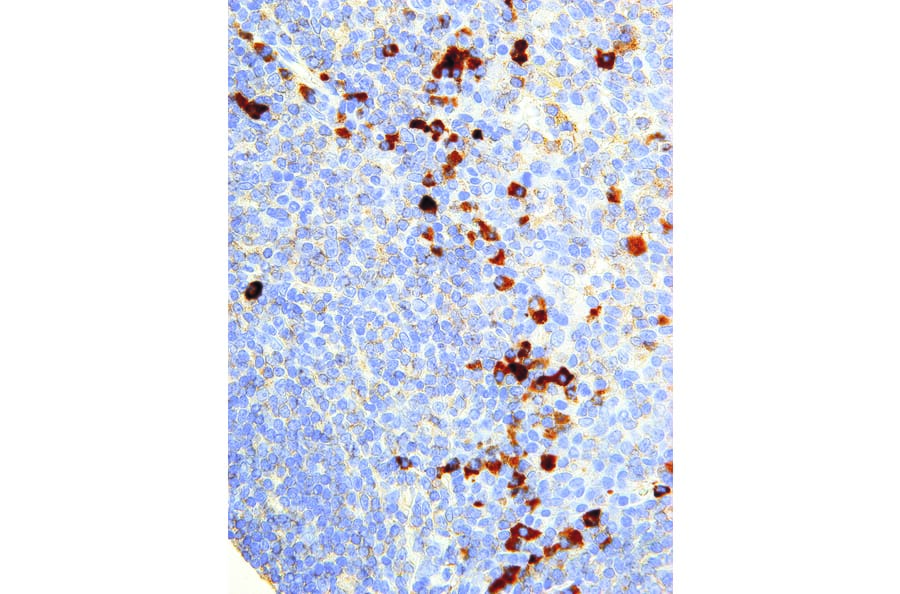 Immunohistochemistry - Anti-NFkB p105/p50 Antibody [IHC610] (A324422) - Antibodies.com