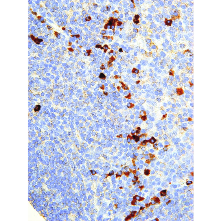 Immunohistochemistry - Anti-NFkB p105/p50 Antibody [IHC610] (A324422) - Antibodies.com