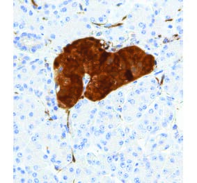 Immunohistochemistry - Anti-NSE Antibody [IHC641] (A324423) - Antibodies.com