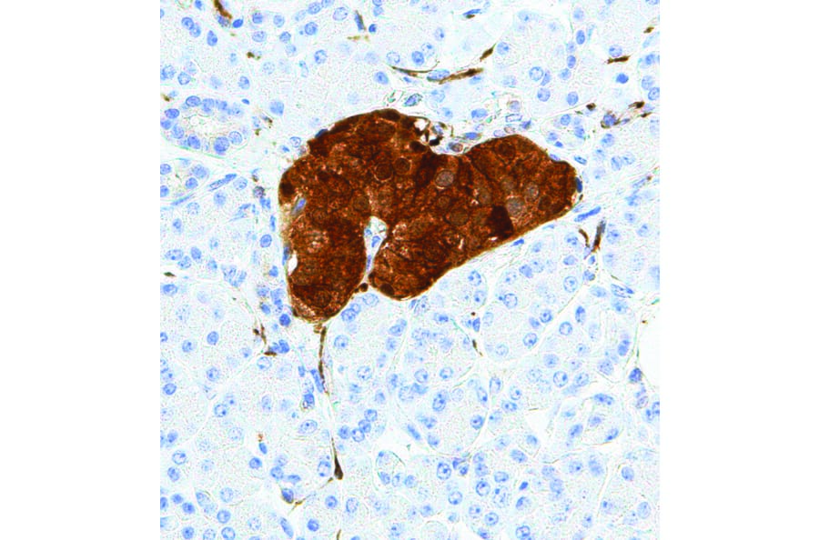 Immunohistochemistry - Anti-NSE Antibody [IHC641] (A324423) - Antibodies.com