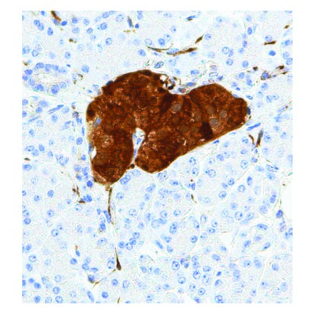 Immunohistochemistry - Anti-NSE Antibody [IHC641] (A324423) - Antibodies.com